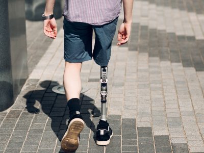Disabled young man with foot prosthesis walks along the street.